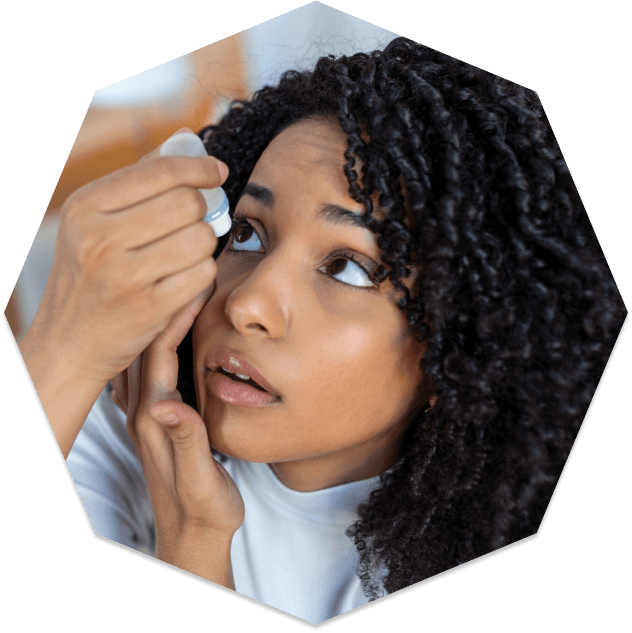 Woman putting in dry eye drops Woman putting in dry eye drops