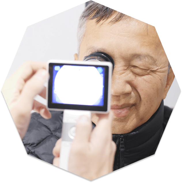 Advanced diagnostic technology for glaucoma at Insight Eyecare in Somerville, NJ