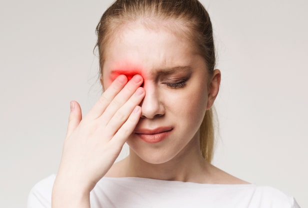 Woman with red eyes from dry eye
