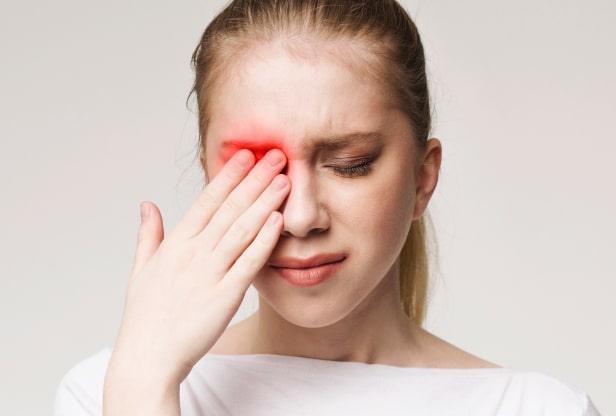Woman with red eyes from dry eye Woman with red eyes from dry eye
